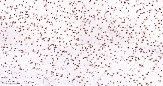 Tar DNA 结合蛋白43即用型免疫组化试剂盒-IHC0429